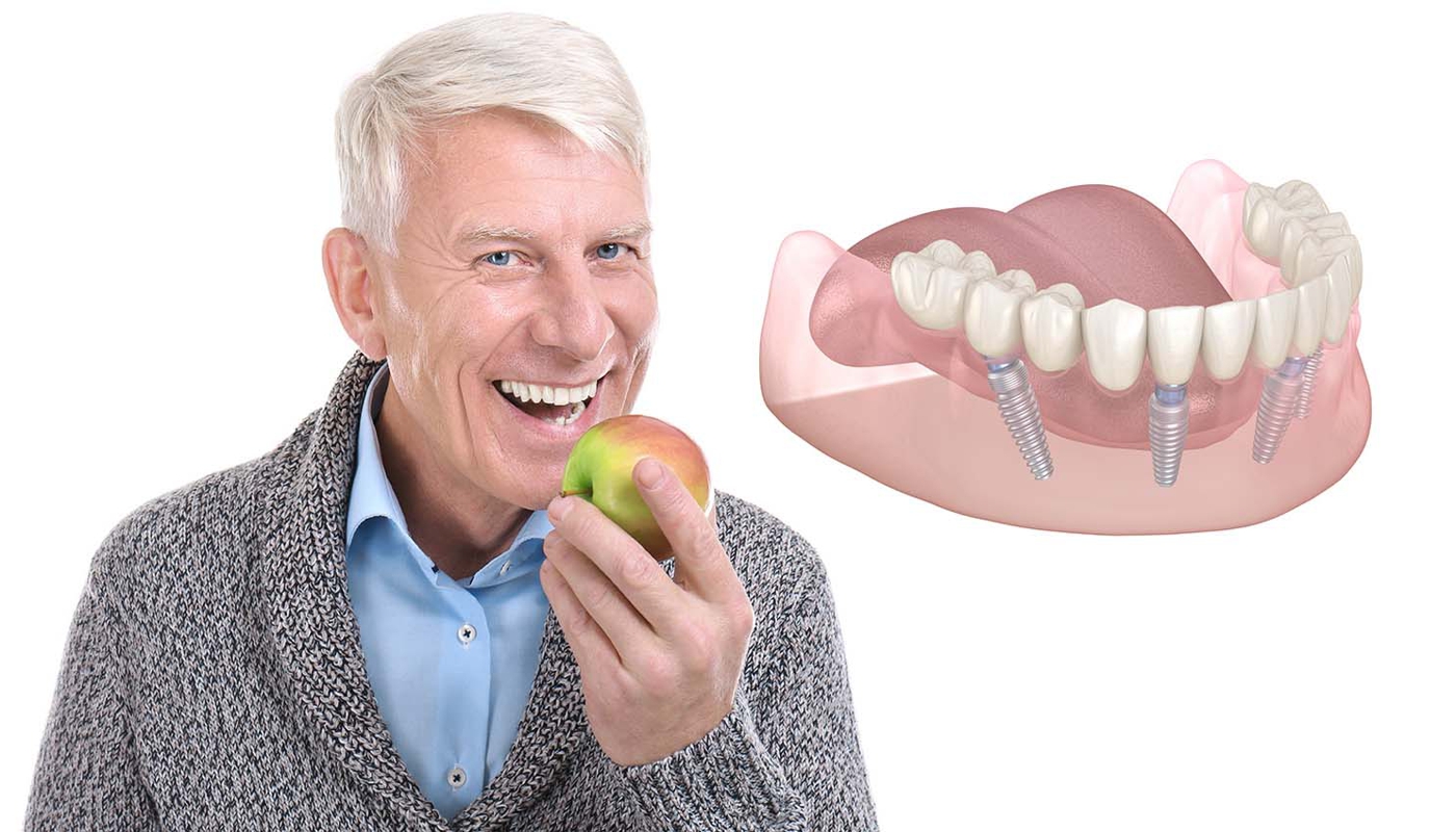 Denti fissi in poche ore per pazienti di Catanzaro e provincia